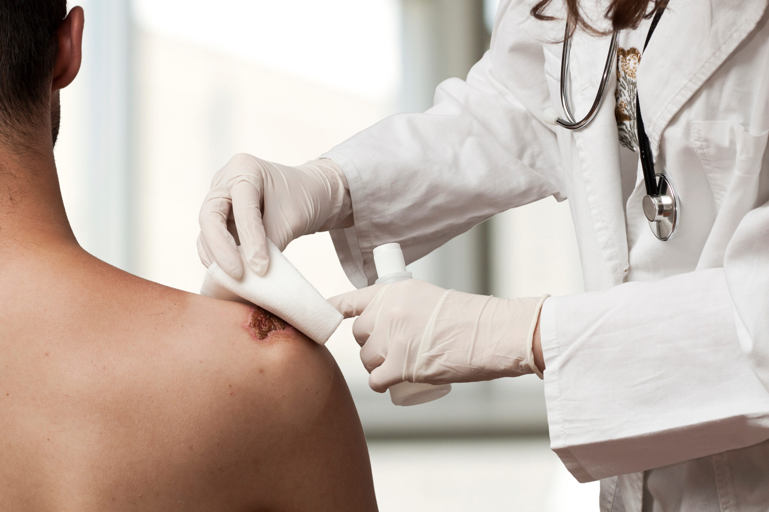 Medical assistant changes the dressing of a wound at the emergency room